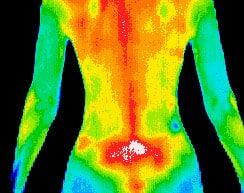 Thermogram detects physiological changes in the body and can help determine where your general aches and pains are originating from.