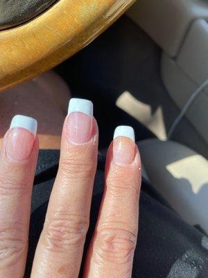 Nail repair but not the right shape.