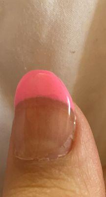 Acrylic chipping and unevenness