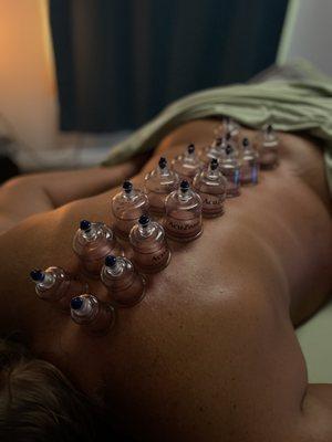 Add cupping for no extra cost