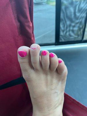 Gel pedicure 3 days in. What????