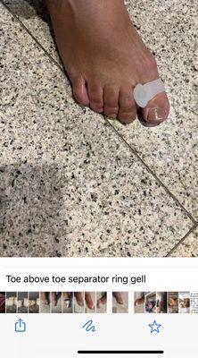 Toe ring