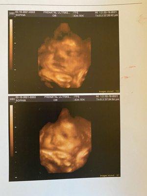 Prenatal Ultrasound of Glendale