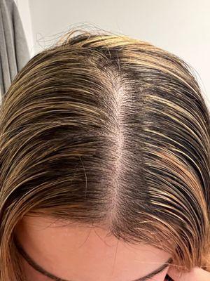 Botched highlights