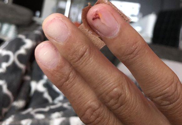 Split ring finger nail while removing acrylics