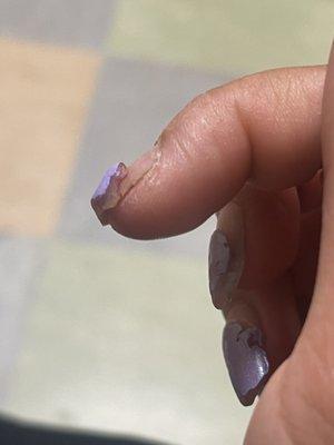 This is aftermath of the nail.