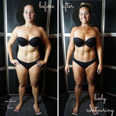 Before and after Body Contouring! Ask us about this device to find out more!