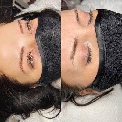 Microblading