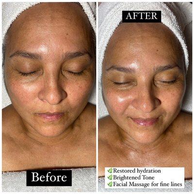 Before and After of Custom Facial