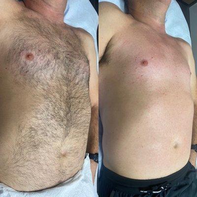 Mens Full Chest Wax