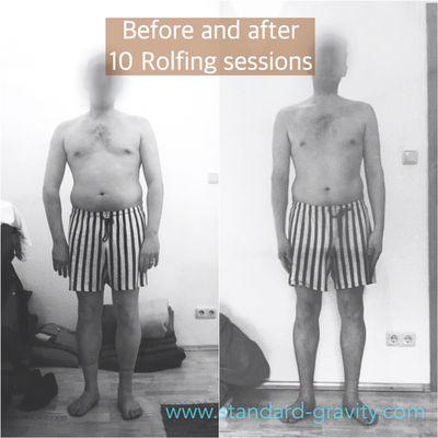 This is a client before his first Rolfing session and after his 10th session.