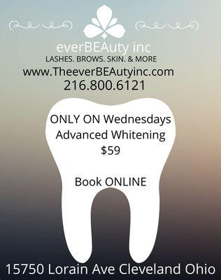 Wednesday teeth whitening special