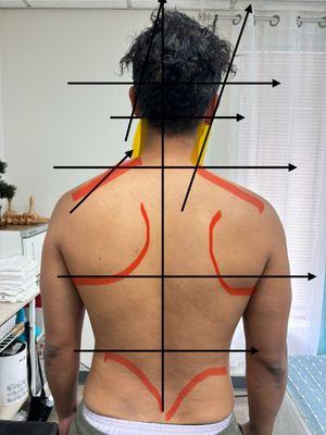 Assessment before the therapy begins.
Here we can see what creates the pain and tightness and what to work on to release the pain.