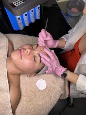 Hydrafacial