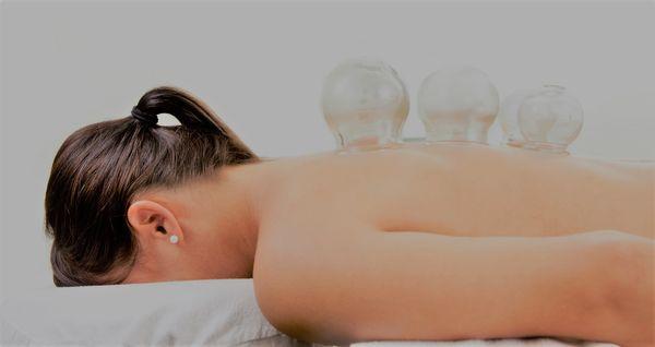 Cupping, Acupuncture in Lynnwood, Eden Clinic