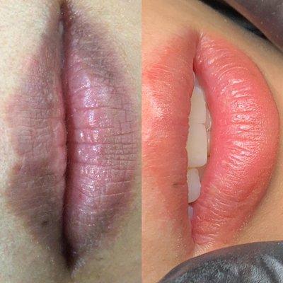 lip blush