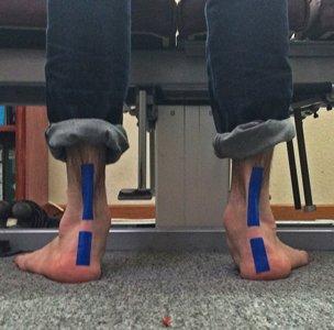 This is what I started with, and when I stand on my orthotics the alignment is now straight.