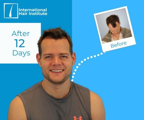 Our client after 12 days!