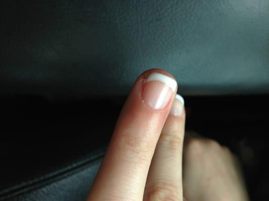 My friend's messed up nail.