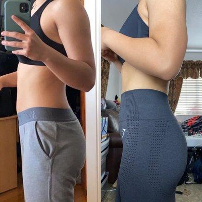 stomach before and after pics!