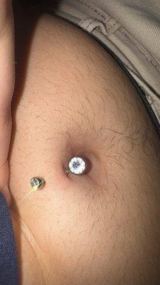 My extremely irritated navel piercing (this piercing was fully heeled prior to getting the jewelry change.)