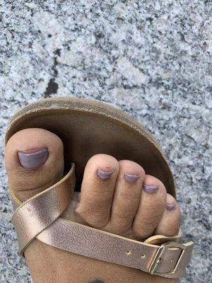 Toes were injured due to poor pedi