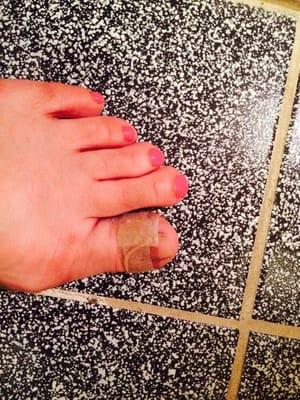 My bloody toe.