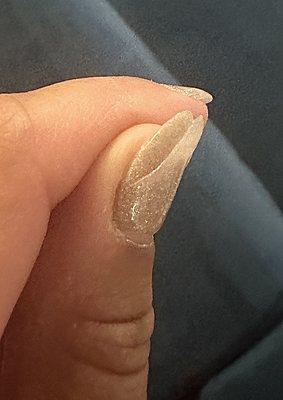 Nail began peeling only after a few hours. Several did this only after 5 days.