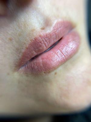 Healed single session of lip blush