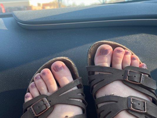 uneven and ridged pedicure