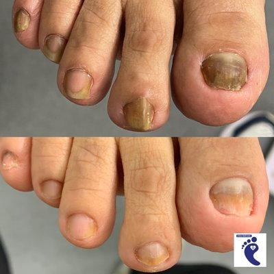 Clinical Pedicures