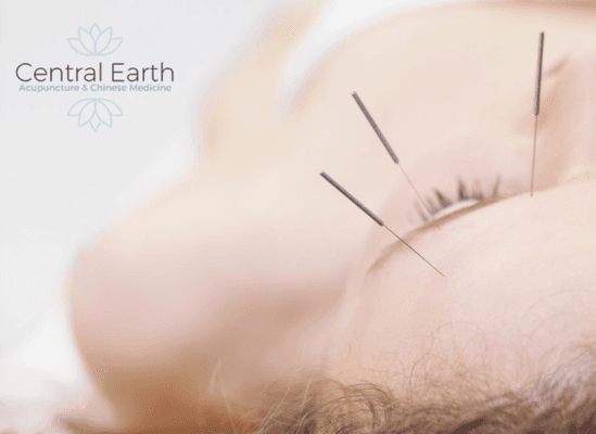 Central Earth Acupuncture OAHU Treatment Services: 
FACIAL Acupuncture Treatment for Women and Men. Schedule Appointment  808-582-8660.