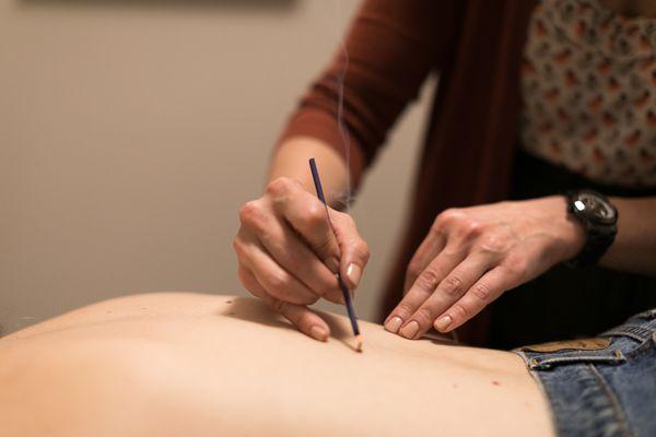 Julia performing Moxabustion on a patient in a private room.