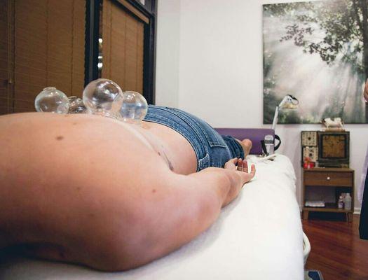 Photo credit: Forestt LaFave
Cupping