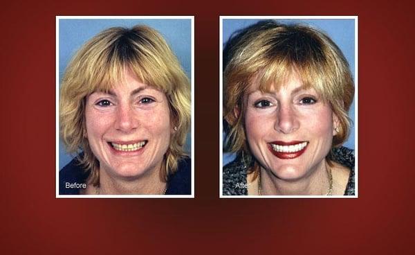 The Art Of Dentistry (Before/ After)