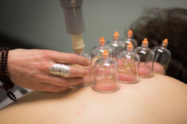 Cupping therapy.