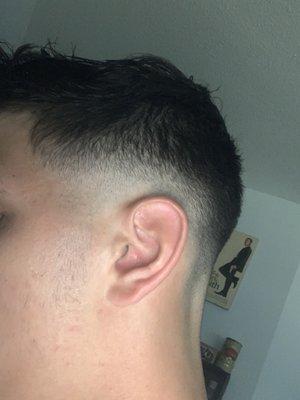 Bad skin fade