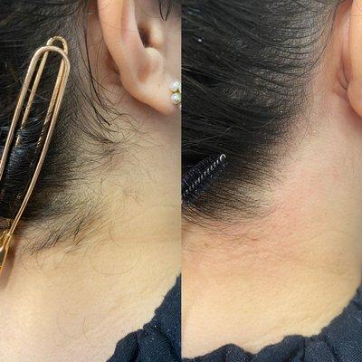 Before and after neck service