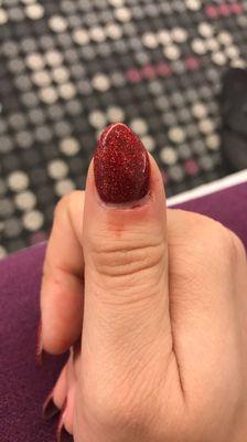 Bleeding cuticle and bad shaping of nail