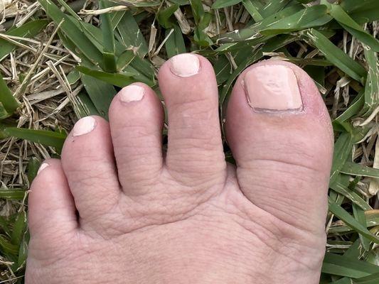 Another smudged toenail due to too much polish