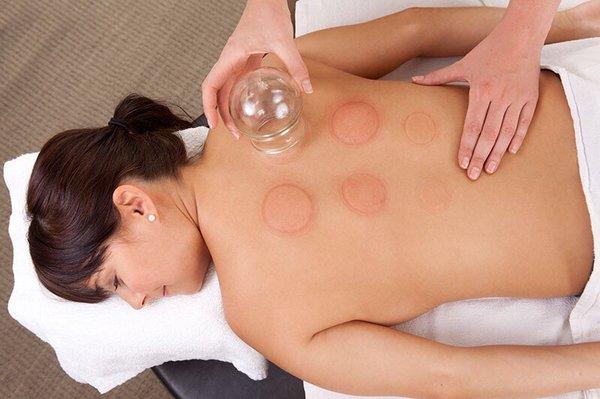 Cupping suction enable detoxification of inner accumulated residues.