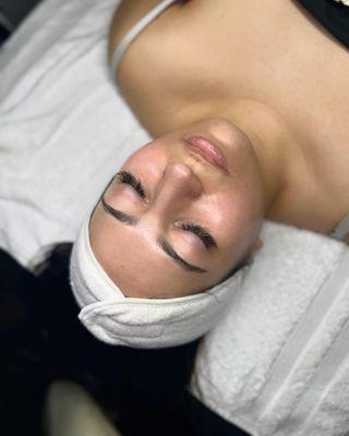 Dermaplane Facial