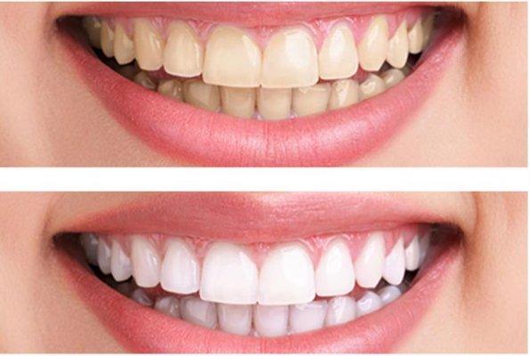 Natural Smiles Dentistry