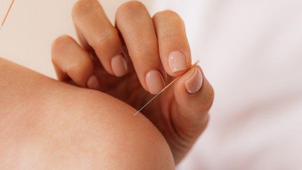 Acupuncture has been shown to help with many conditions, as well as bring about a sense of calm.