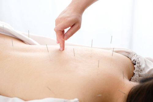 Lei Wang Acupuncture at Precision Healing