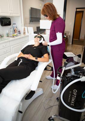 Lumecca IPL Treatment