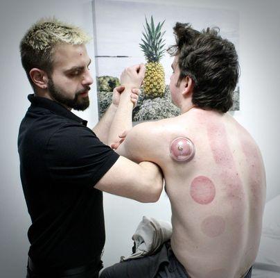 Active Cupping Massage Therapy with Passive Range Of Motion to help recover from Rotator Cuff Injury!