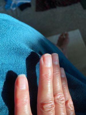 Ring finger cuticle just healed after 2 weeks-such a bad cut