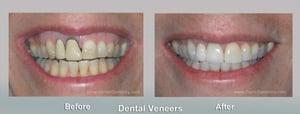 Miami Dentist Cosmetic Dentistry