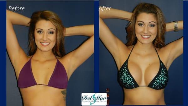 See Ashton's Before & After video!   http://bit.ly/1i57jjU